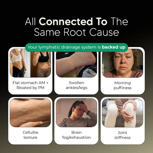 Nueva Fórmula de Máxima Potencia – Cápsulas de Drenaje Linfático eskin™ Sculpt